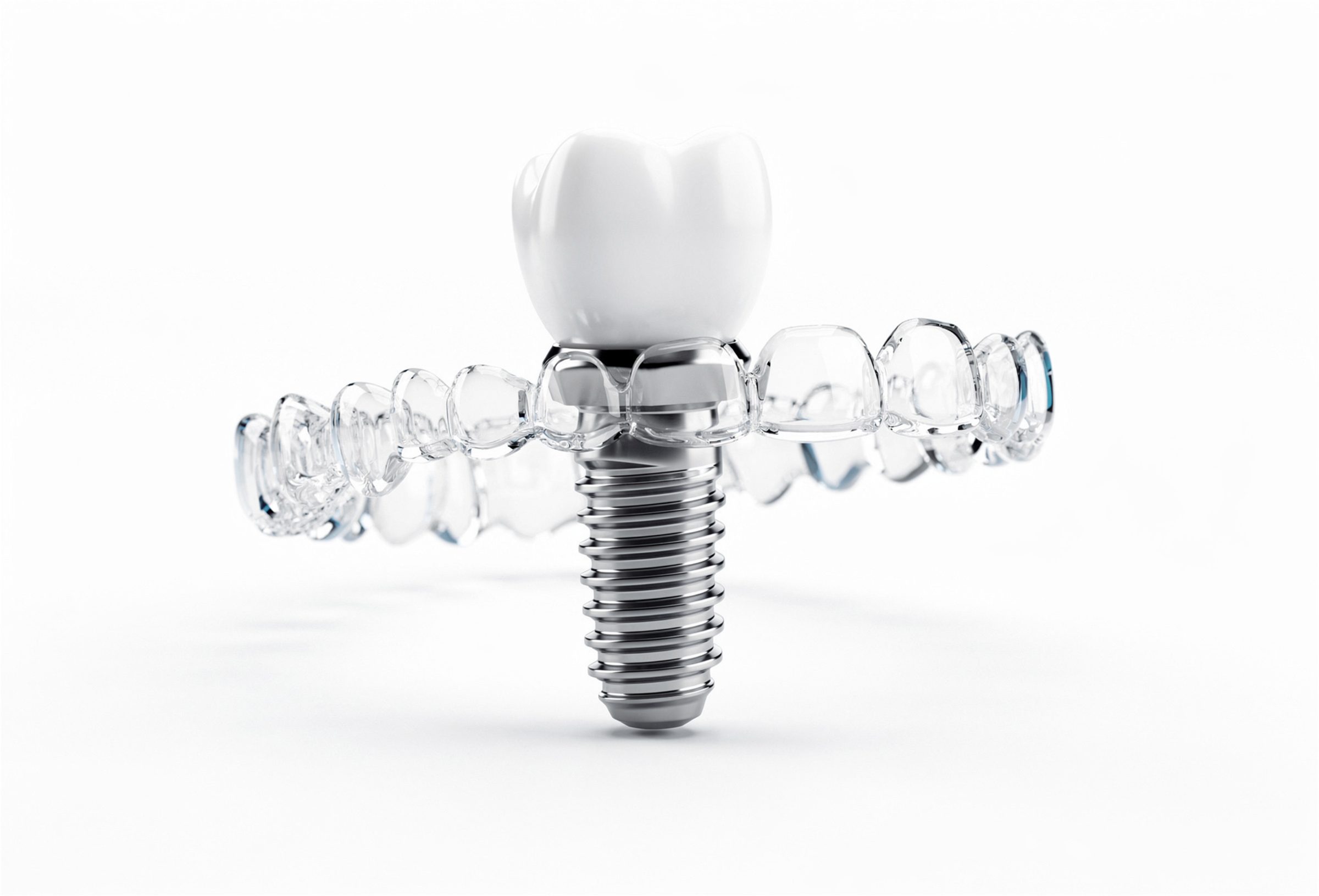 3D model of a dental implant: titanium post, abutment and crown, with a clear dental arch behind it