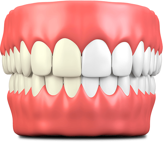How a professional bleaching agent reaches internal stains