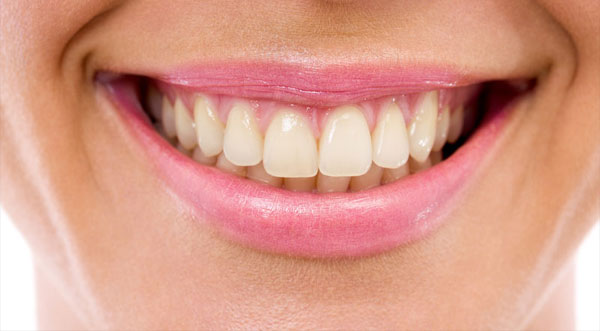 Discoloured teeth before whitening