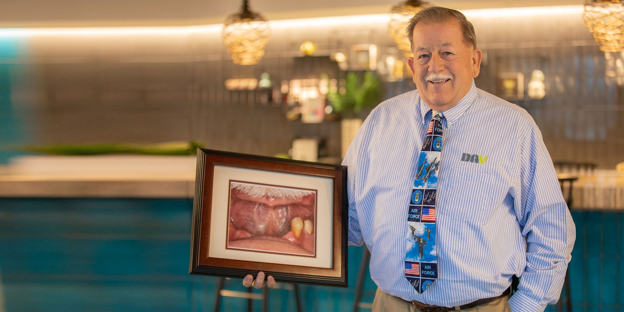 A patient holding a framed photograph of his mouth before treatment